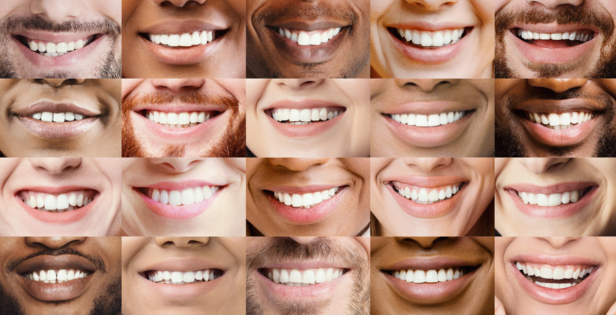 Imagen de varias bocas de pacientes para introducir el apartado casos clínicos.